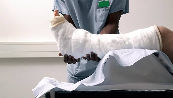 Fixing Internal Fractures of Bones